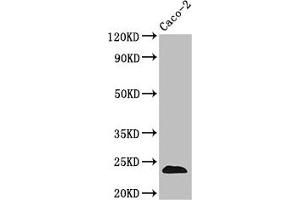 Western Blot Positive WB detected in: Caco-2 whole cell lysate All lanes: CLDN3 antibody at 3. (Claudin 3 antibody  (AA 181-220))