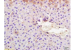 Formalin-fixed and paraffin embedded mouse liver labeled with Rabbit Anti SYVN1/HRD1 Polyclonal Antibody, Unconjugated (ABIN671811) at 1:200 followed by conjugation to the secondary antibody and DAB staining (SYVN1 antibody  (AA 531-617))