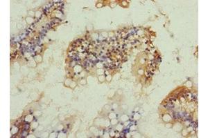 Immunohistochemistry of paraffin-embedded human small intestine tissue using ABIN7161238 at dilution of 1:100 (Neuritin 1-Like antibody  (AA 1-165))