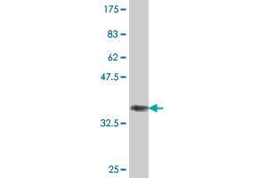 Western Blot detection against Immunogen (35. (FOXC1 antibody  (AA 464-553))