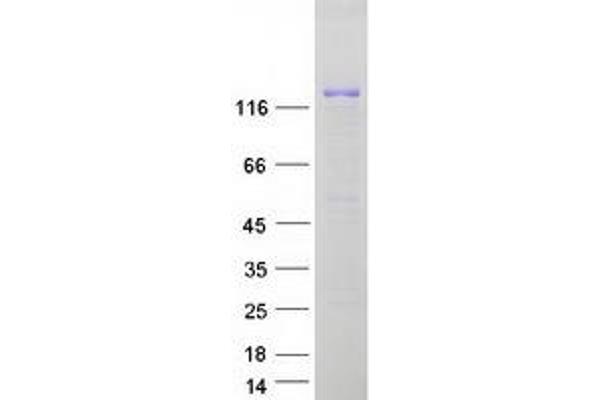 ERCC6 Protein (Myc-DYKDDDDK Tag)