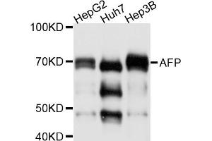 Western blot analysis of extracts of various cell lines, using AFP antibody (ABIN5882728). (alpha Fetoprotein antibody)