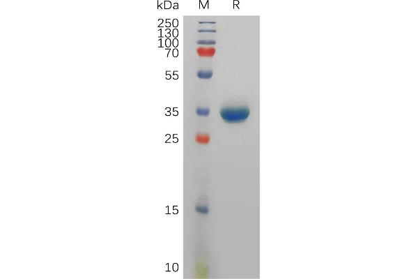 Peptide YY Protein (PYY) (Fc Tag)