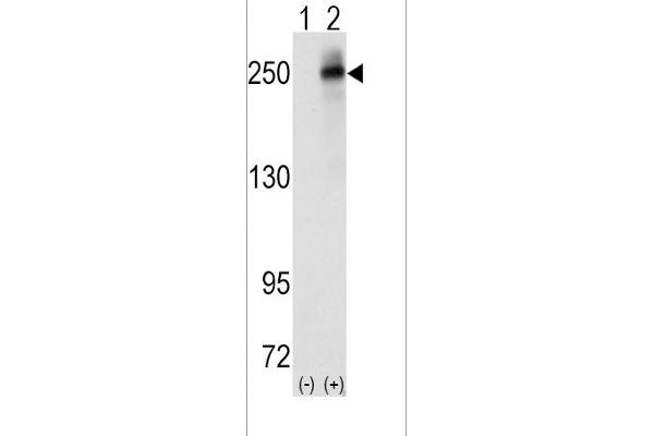 ALK antibody  (AA 636-666)