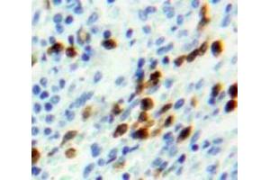 Used in DAB staining on fromalin fixed paraffin-embedded Spleen tissue (NUP107 antibody  (AA 554-784))