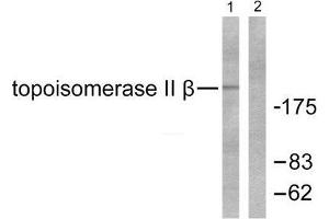 Western Blotting (WB) image for anti-Topoisomerase (DNA) II beta 180kDa (TOP2B) (N-Term) antibody (ABIN1848858) (TOP2B antibody  (N-Term))