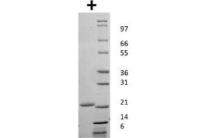 SDS-PAGE of Mouse Granulocyte Colony Stimulating Factor Recombinant Protein SDS-PAGE of Mouse Granulocyte Colony Stimulating Factor Recombinant Protein. (G-CSF Protein)