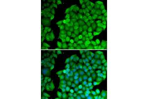 Immunofluorescence (IF) image for anti-Cyclin D2 (CCND2) antibody (ABIN1875413) (Cyclin D2 antibody)