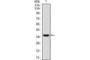 Western Blotting (WB) image for anti-Interleukin 2 Receptor, alpha (IL2RA) (AA 34-139) antibody (ABIN1724861)