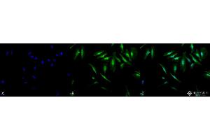 Immunocytochemistry/Immunofluorescence analysis using Rabbit Anti-Alpha B Crystallin Polyclonal Antibody . (CRYAB antibody  (Atto 594))