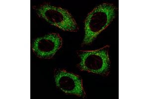 Fluorescent image of U251 cell stained with MAP2K2 Antibody (T394). (MEK2 antibody  (AA 372-400))