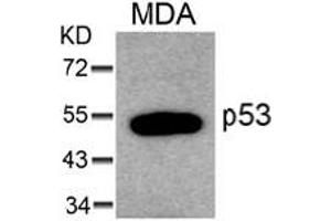 Image no. 1 for anti-Tumor Protein P53 (TP53) (AA 4-8) antibody (ABIN319299) (p53 antibody  (AA 4-8))