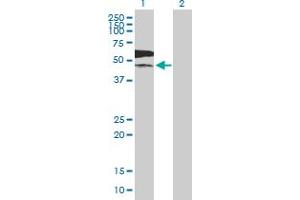Western Blot analysis of PKLR expression in transfected 293T cell line by PKLR MaxPab polyclonal antibody. (PKLR antibody  (AA 1-574))