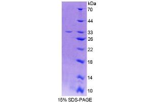 SDS-PAGE analysis of Rat THYN1 Protein. (THYN1 Protein)