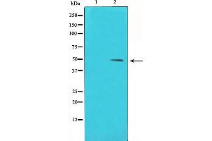 Western blot analysis of Cyclin E1 phosphorylation expression in Paclitaxel treated HeLa whole cell lysates,The lane on the left is treated with the antigen-specific peptide. (Cyclin E1 antibody  (pThr395))