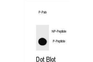 Dot blot analysis of Phospho-BAD-S71 Antibody Phospho-specific Pab l on nitrocellulose membrane. (BAD antibody  (pSer71))