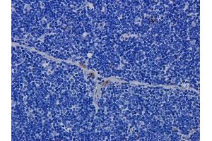 Immunohistochemistry (IHC) image for anti-CD52 (CD52) antibody (ABIN5668232)