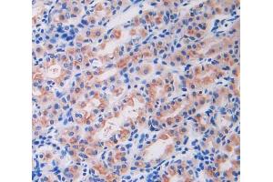 IHC-P analysis of stomach tissue, with DAB staining. (IL18R1 antibody  (AA 147-255))