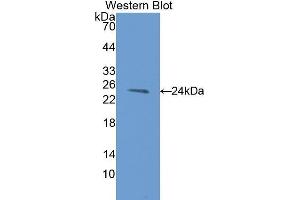 Western Blotting (WB) image for anti-Anterior Gradient Homolog 2 (Xenopus Laevis) (AGR2) (AA 21-175) antibody (ABIN1077804) (AGR2 antibody  (AA 21-175))