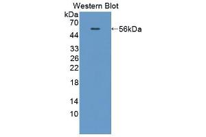 Western blot analysis of the recombinant protein. (Coagulation Factor X antibody  (AA 21-481))