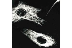 Immunocytochemistry (ICC) image for anti-Vimentin (VIM) antibody (ABIN94491)