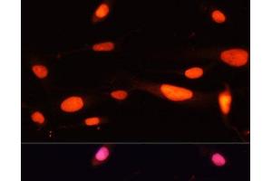 Immunofluorescence analysis of U-2 OS cells using MCM5 Polyclonal Antibody at dilution of 1:100. (MCM5 antibody)