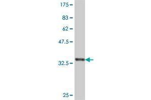 Western Blot detection against Immunogen (38. (GMPPB antibody  (AA 1-110))