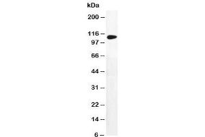 Western blot testing of DPYD antibody and MM231 cell lysate (DPYD antibody  (AA 33-52))