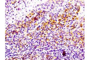 Immunohistochemistry (IHC) image for anti-CD81 (CD81) antibody (ABIN7127284)