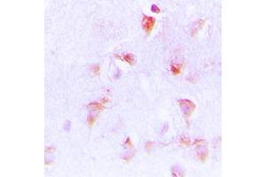 Immunohistochemical analysis of C1QBP staining in human brain formalin fixed paraffin embedded tissue section. (C1QBP antibody  (Center))