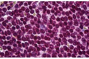 Human Spleen: Formalin-Fixed, Paraffin-Embedded (FFPE) (ATF6 antibody  (AA 91-194))