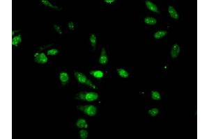 Immunofluorescent analysis of Hela cells treated with NaB using ABIN7139187 at dilution of 1:100 and Alexa Fluor 488-congugated AffiniPure Goat Anti-Rabbit IgG(H+L) (HIST1H4A antibody  (acLys5))
