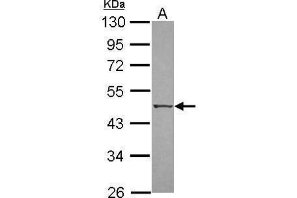 DAPK3 antibody  (N-Term)