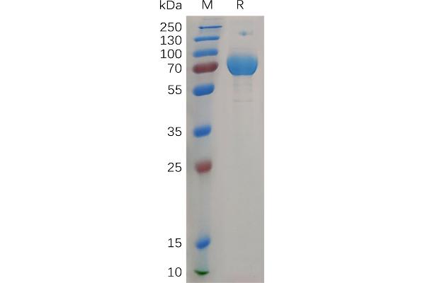 IFNGR2 Protein (AA 28-247) (Fc Tag)