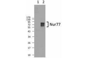 Western Blotting (WB) image for anti-Nuclear Receptor Subfamily 4, Group A, Member 1 (NR4A1) antibody (ABIN2666405) (NR4A1 antibody)