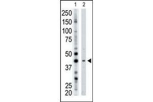 Image no. 1 for anti-ADP-Ribosyltransferase 3 (ART3) (N-Term) antibody (ABIN357663) (ART3 antibody  (N-Term))