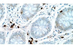 Human colon: immunohistochemical staining for Interleukin 6. (IL-6 antibody  (N-Term))