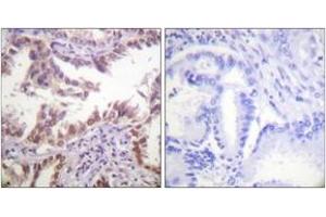 Immunohistochemistry (IHC) image for anti-Histone 3 (H3) (AA 6-55) antibody (ABIN2890739) (Histone 3 antibody  (AA 6-55))