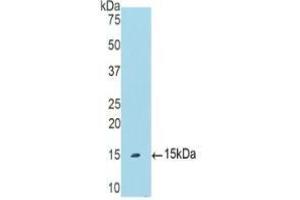 Western blot analysis of recombinant Human PIGR. (PIGR antibody  (AA 462-561))