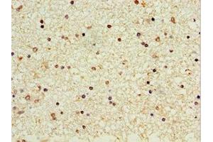 Immunohistochemistry of paraffin-embedded human brain tissue using ABIN7162964 at dilution of 1:100 (CROT antibody  (AA 1-87))