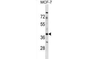 Western Blotting (WB) image for anti-Zygote Arrest 1 (ZAR1) antibody (ABIN2998776) (Zygote Arrest 1 antibody)