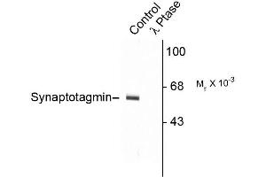 Western blots of rat cortex lysate showing specific immunolabeling of the ~60k - ~62k synaptotagmin phosphorylated at Thr202 (Control). (SYT1 antibody  (pThr202))