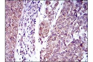 Immunohistochemistry (IHC) image for anti-Interleukin 2 Receptor, alpha (IL2RA) (AA 34-139) antibody (ABIN1724861)