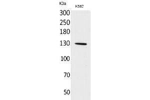 Western Blot analysis of K562 cells using Apaf-1 Polyclonal Antibody. (APAF1 antibody  (Internal Region))