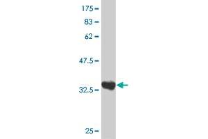 Western Blot detection against Immunogen (35. (ZIC3 antibody  (AA 182-274))