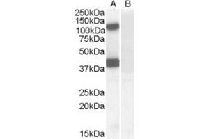 Western Blotting (WB) image for anti-erythrocyte Membrane Protein Band 4.1-Like 2 (EPB41L2) (Internal Region) antibody (ABIN2465655) (EPB41L2 antibody  (Internal Region))
