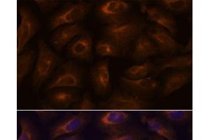 Immunofluorescence analysis of U-2 OS cells using GPR22 Polyclonal Antibody at dilution of 1:100. (GPR22 antibody)