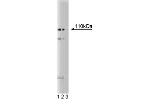 Western blot analysis of PI4-Kinase beta on a HeLa lysate. (pi 4-Kinase, beta (AA 411-626) antibody)