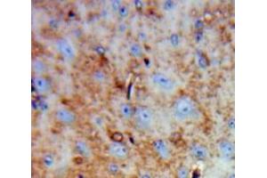 Used in DAB staining on fromalin fixed paraffin-embedded Brain tissue (FAM19A4 antibody  (AA 46-139))