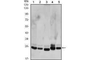 Western blot analysis using CBX1 mouse mAb against Hela (1), COS7 (2), NIH/3T3 (3), A431 (4),and C6 (5) cell lysate. (CBX1 antibody)